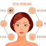 Acnelyse % 0.05 Cream